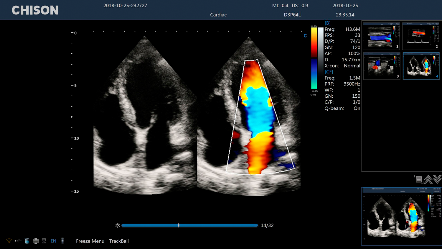 CBit 4 Cardiac BBC